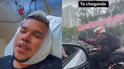 Mc Buarque perde parte da orelha em acidente