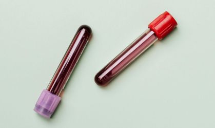 O que é a hemoterapia? Médicos explicam se uso do próprio sangue funciona