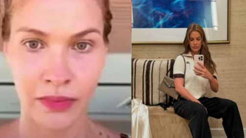 Andressa Suita fala de acidente com box do banheiro