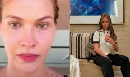 Andressa Suita sofre acidente doméstico e faz alerta: "Usem película no box"