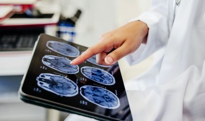 Close-up Shot of a Doctor's Hand Pointing on Brain Scan Images  on Digital Tablet