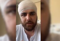 Zé Neto retira curativo e mostra cicatriz de acidente; veja vídeo