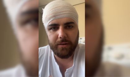 Zé Neto retira curativo e mostra cicatriz de acidente; veja vídeo