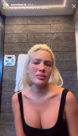 Karoline Lima chorou ao contar que sofreu com pressão estética • Instagram/Karoline Lima