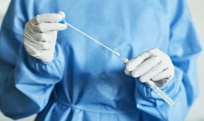 SP implanta teste rápido que detecta nova variante da Mpox