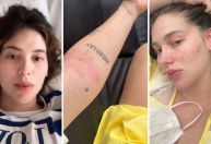 Virginia retorna ao hospital após alta médica: "Continuo inchando"