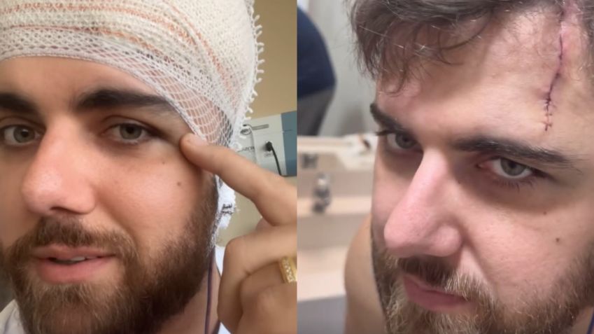Zé Neto falo sobre o corte que sofreu após o acidente de quadriciclo • Instagram/Zé Neto