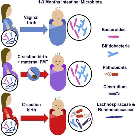 Resumo gráfico do artigo sobre transplante de microbiota fecal materna em bebês nascidos por cesárea • Katri Korpela /Cell, 2024