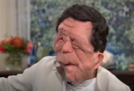 Quem é Adam Pearson, ator com doença rara e degenerativa que estrela filme?