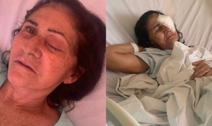 Prefeitura deve indenizar pacientes infectados em mutirão de catarata no RN