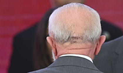 Lula detalha acidente doméstico que causou ferimento na cabeça; veja relato
