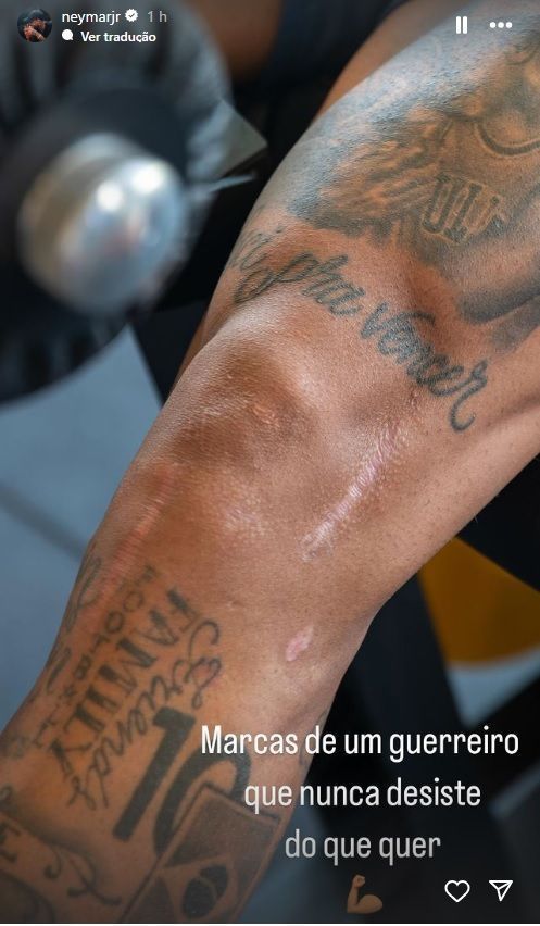 Neymar posta foto das cicatrizes no joelho após cirurgias • Reprodu~]ao/Instagram