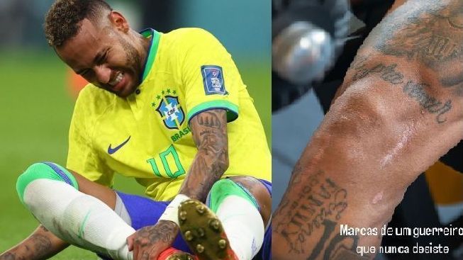 Neymar posta foto de cicatrizes das cirurgias que fez após lesão