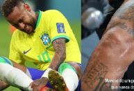 Neymar mostra cicatrizes após cirurgias e um ano sem jogar; veja fotos