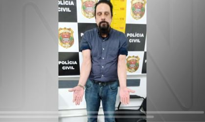 Ex-mulher diz que Cupertino quebrou sua costela 7 vezes