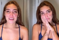 Ex-BBB Vanessa Lopes chora e desabafa sobre acne: "Não aguento mais"