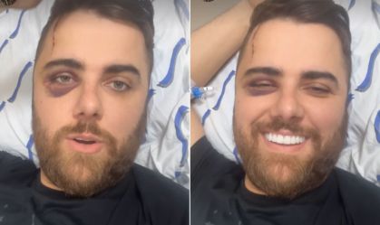 Com olho roxo, Zé Neto revela data que terá alta no hospital
