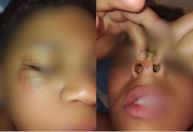Menino de 12 anos é agredido na escola após ser exposto por Pablo Marçal