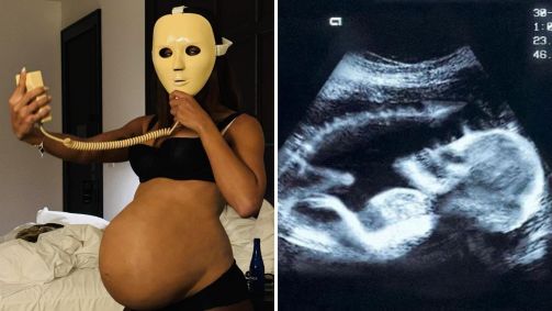 Nas redes sociais, cantora vem instigando os fãs com os cliques