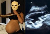 Após foto "grávida", Anitta publica registro de ultrassom: "Não é lindo?"
