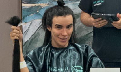 Rafa Uccmann passa por procedimento estético capilar