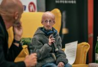 O que é progeria? Doença do envelhecimento precoce faz crianças parecerem idosos