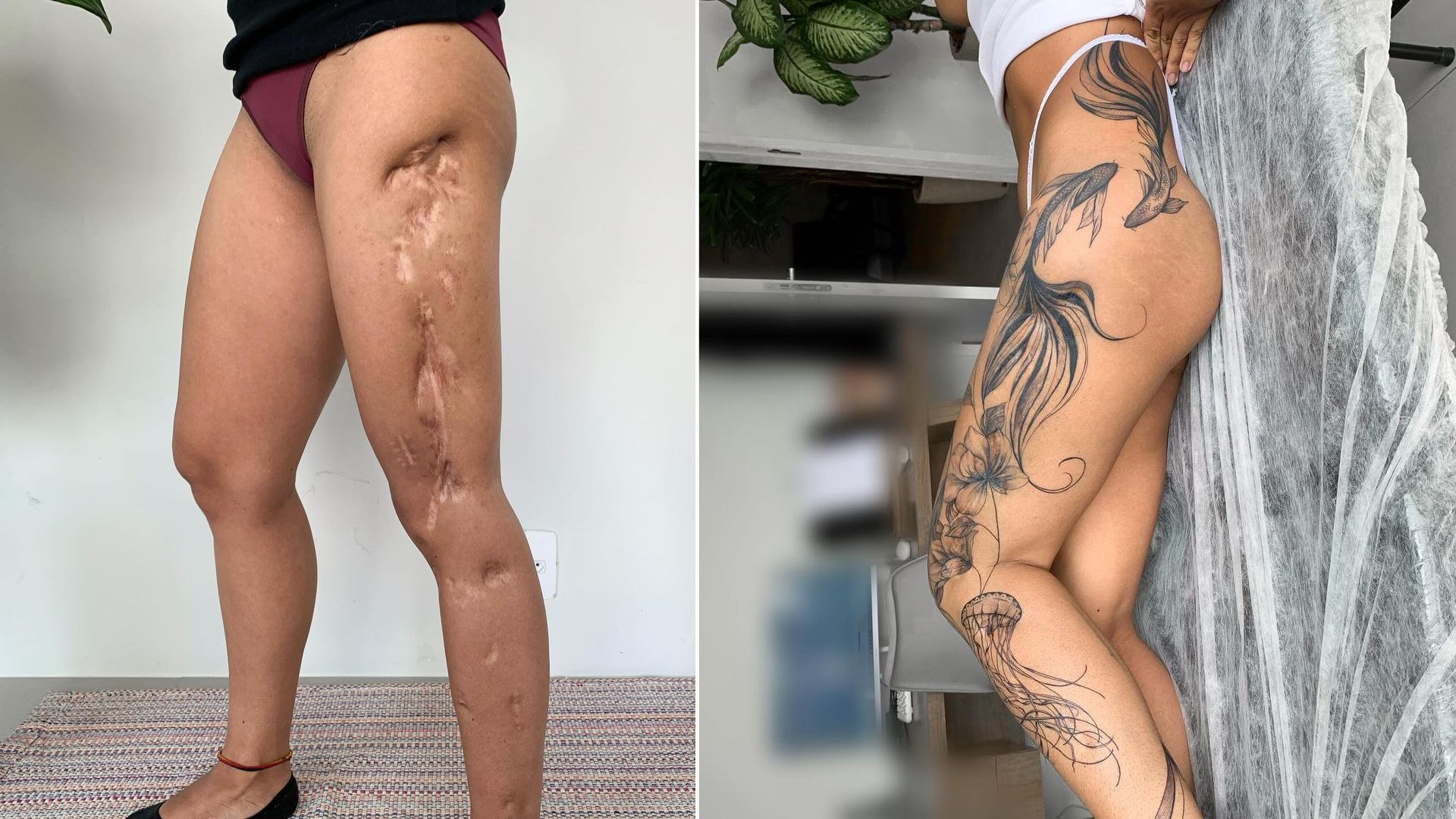 tatuagem-cicatriz (1)