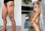 Tatuadoras elencam desenhos mais escolhidos para ressignificar cicatrizes