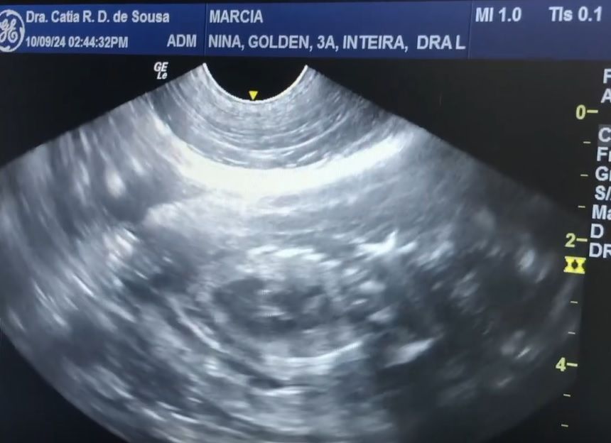 Ultrassom de Golden Retriever que engravidou de Shih Tzu • Reprodução