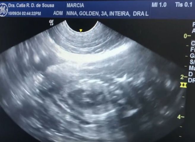 Ultrassom de Golden Retriever que engravidou de Shih Tzu • Reprodução