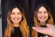 Virgínia renova sorriso com troca de lentes de contato; veja resultado
