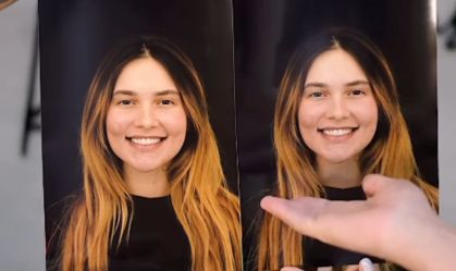 Virgínia renova sorriso com troca de lentes de contato; veja resultado