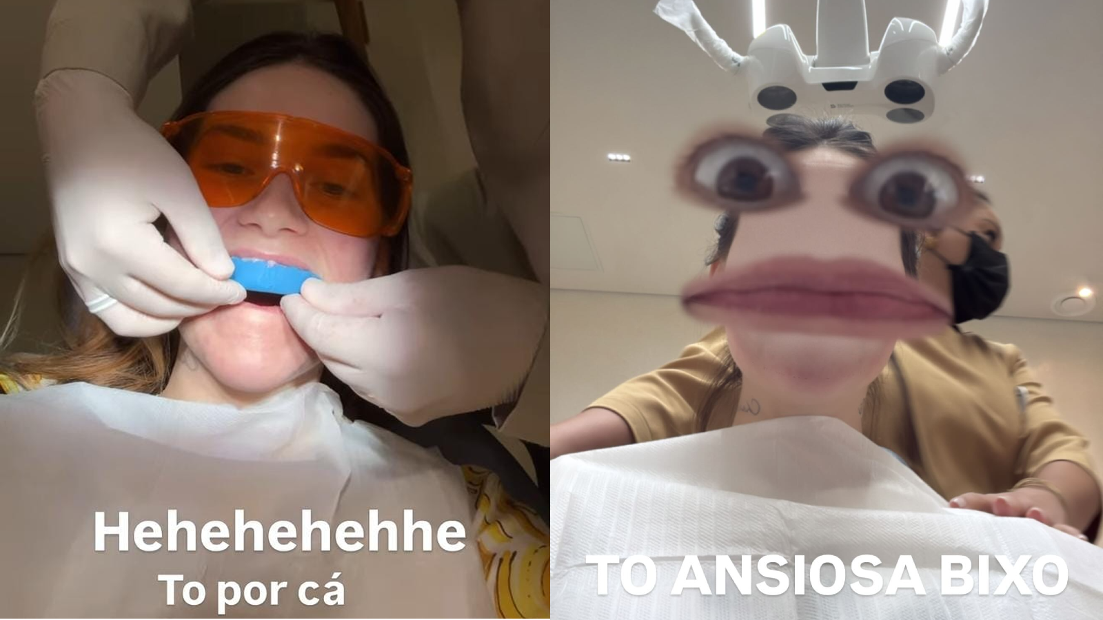 Virginia comentou que iria tirar suas lentes para colocar as novas, dizendo que não mostraria como estão seus dentes reais pois nem ela iria ver