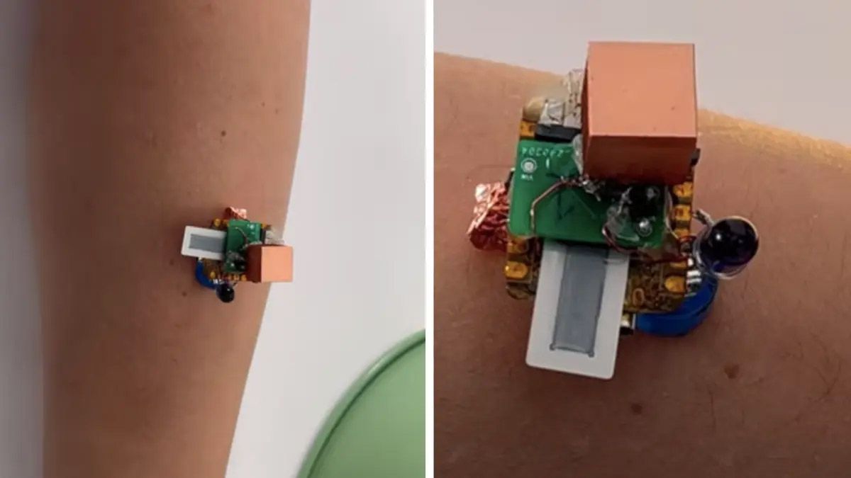 Power-over-Skin é especialmente indicado para detecção longitudinal de saúde • Figlab/Universidade Carnnegie Mellon