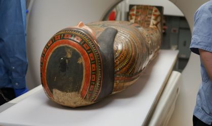 Tomografia ajuda a resolver um mistério de 3 mil anos sobre mulher egípcia