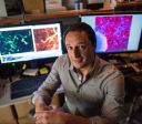 Cientista explica como chumbo influenciou na evolução do cérebro humano