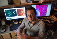 Cientista explica como chumbo influenciou na evolução do cérebro humano