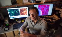 Cientista explica como chumbo influenciou na evolução do cérebro humano