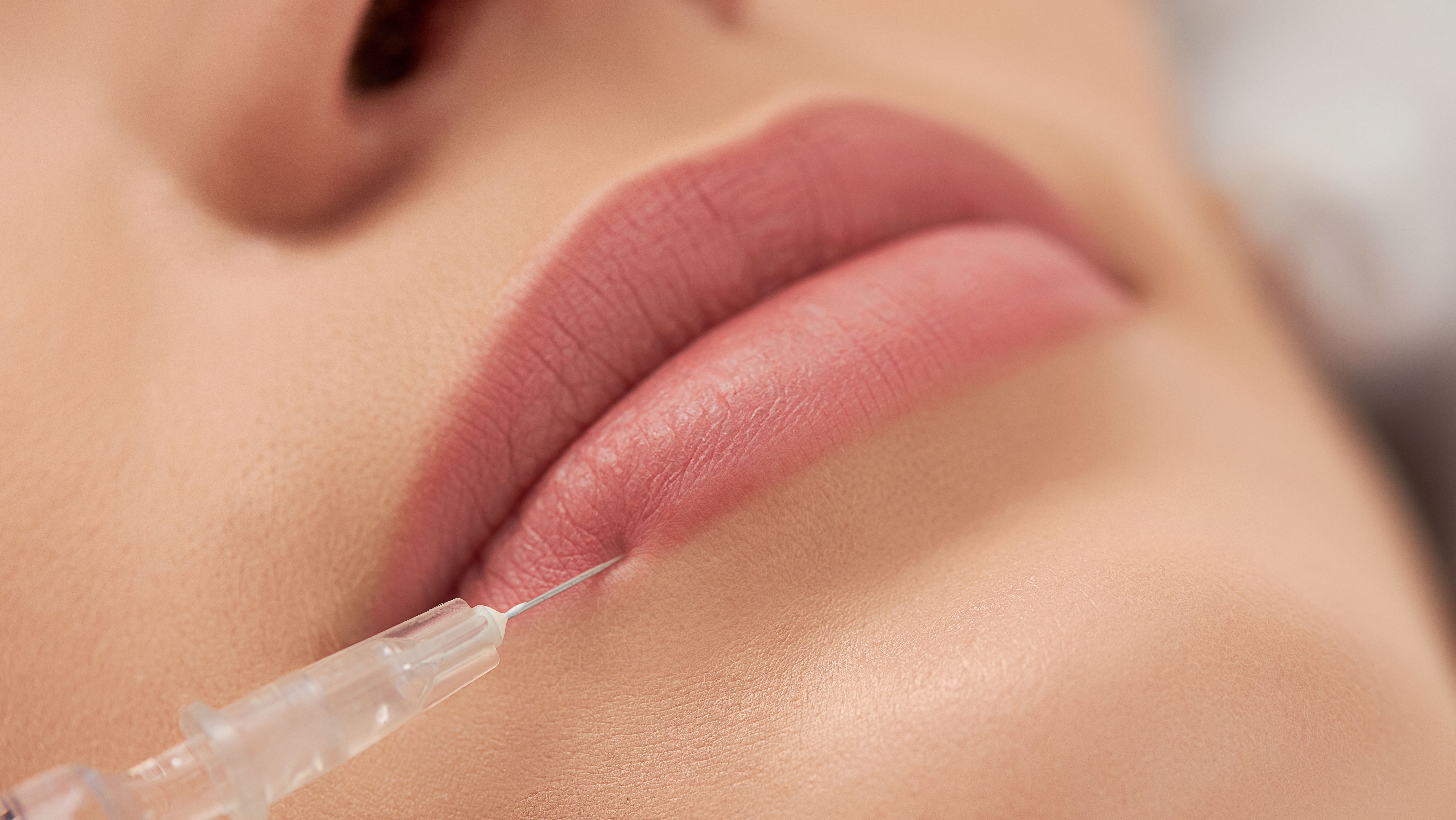 Procedure lip augmentation for young beautiful woman.