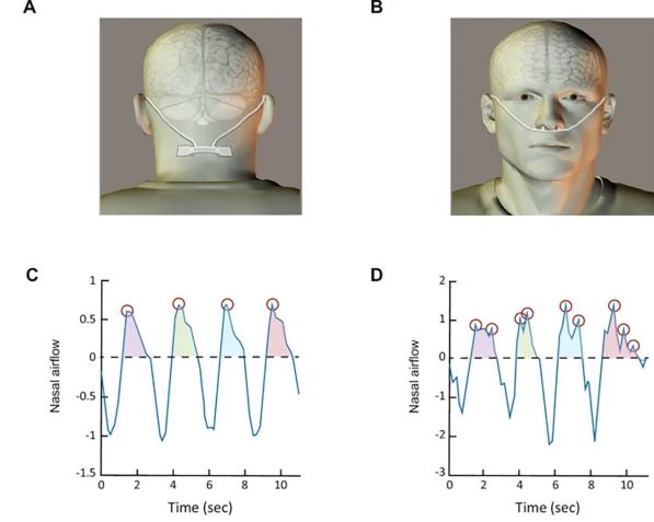 Distinguindo entre frequência respiratória e picos respiratórios • Lior Gorodisky ., Nature Communications, 2024