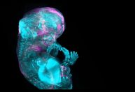 Altas de células humanas mostra como esqueleto é desenvolvido