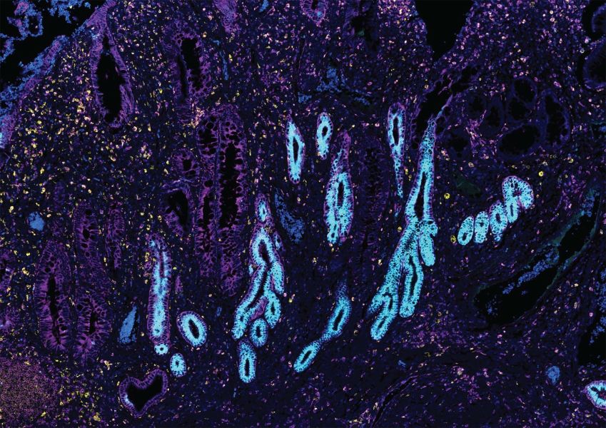 Cientistas mapearam o trato gastrointestinal usando dados de 1,6 milhão de células, incluindo o tecido intestinal mostrado aqui • A. Oliver/N. Huang, R. Li, et al. (2024) via CNN Newsource