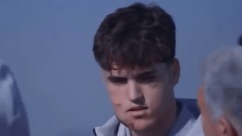 Cubarsí com o rosto inchado na volta de Belgrado • Reprodução