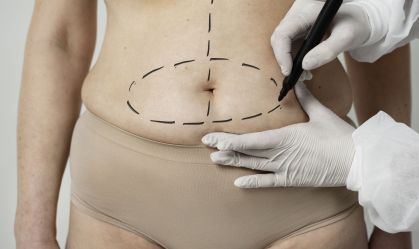 Hidrolipo: entenda o que é e quais são os riscos do procedimento