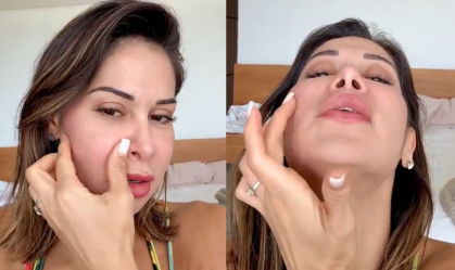 Maíra Cardi fará cirurgia para retirar PMMA do rosto: "Deformada"