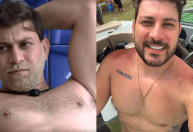 Ex-BBB Caio Afiune fala de procedimento estético nas mamas: "Me incomodava"