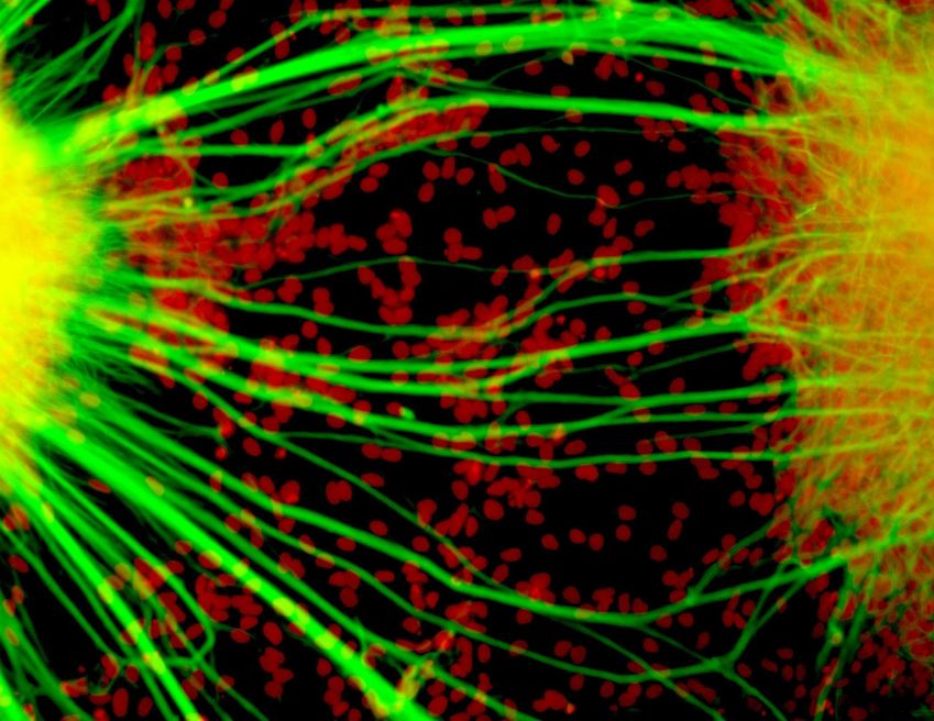 Neurônios humanos: fases da pesquisa demandam presença humana, como a microscopia •