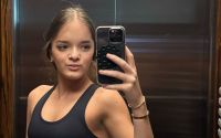 Rafa Justus mostra resultado de rinoplastia de perto; veja