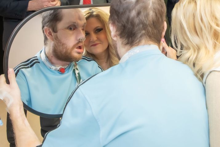 Derek Pfaff, com a mãe Lisa, vê seu novo rosto pela primeira vez • Mayo Clinic