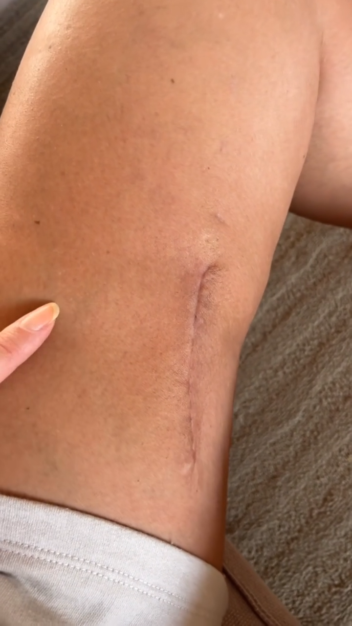 Vera Viel realizou 13ª sessão de radioterapia nesta quarta (27) • Instagram/Vera Viel